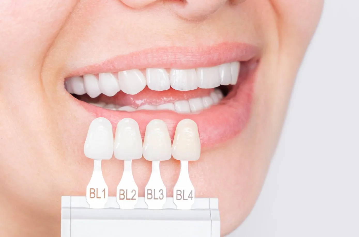 estética dental en málaga